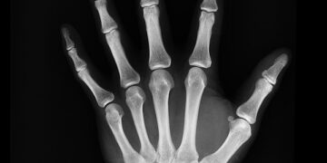 Top Insurance Trends in 2023: What You Need to Know Now